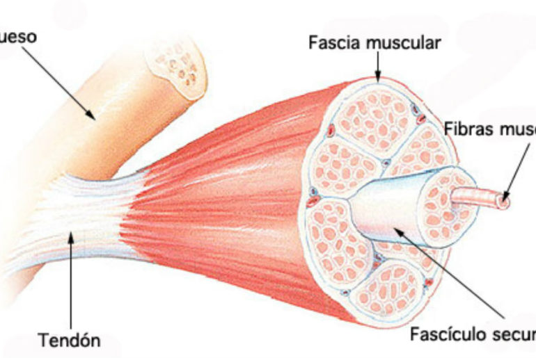 Miofascial - síntomas