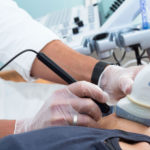 Ferran Abat- ReSport Clinic - Electrolisis